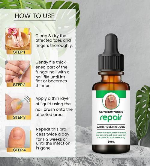 Nail serum for nail repair, fungal infection, anti-infective removal, 100% Natural Profesional 30 ML Serum For Nail Strong, Supple and Shaped Nail Care Serum (30ML PACK OF 1)