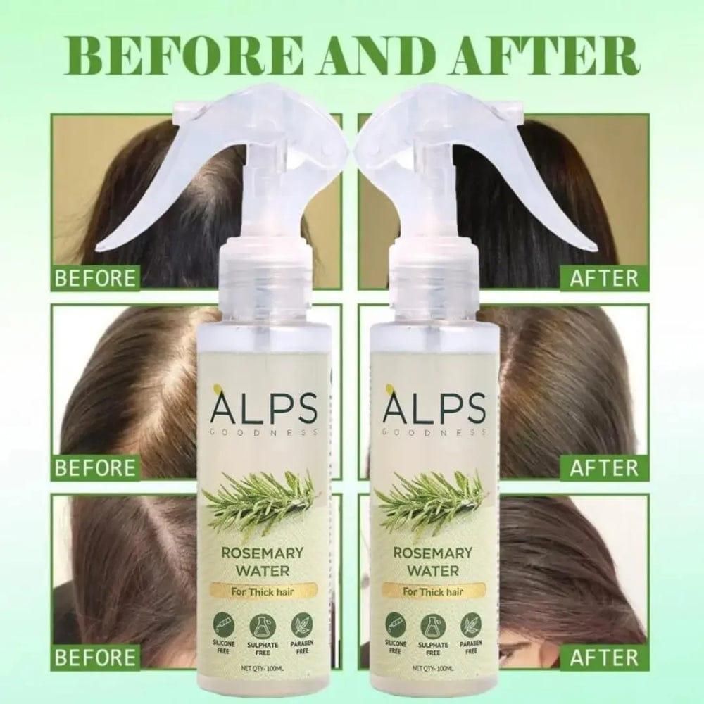 Alps Goodness Rosemary Water Spray (100 ml) | Rosemary water for hair | Hair Spray for Hair Growth | Viral Rosemary Spray | #1 Bestselling Spray Regrowth Buy 1 Get 2 Free