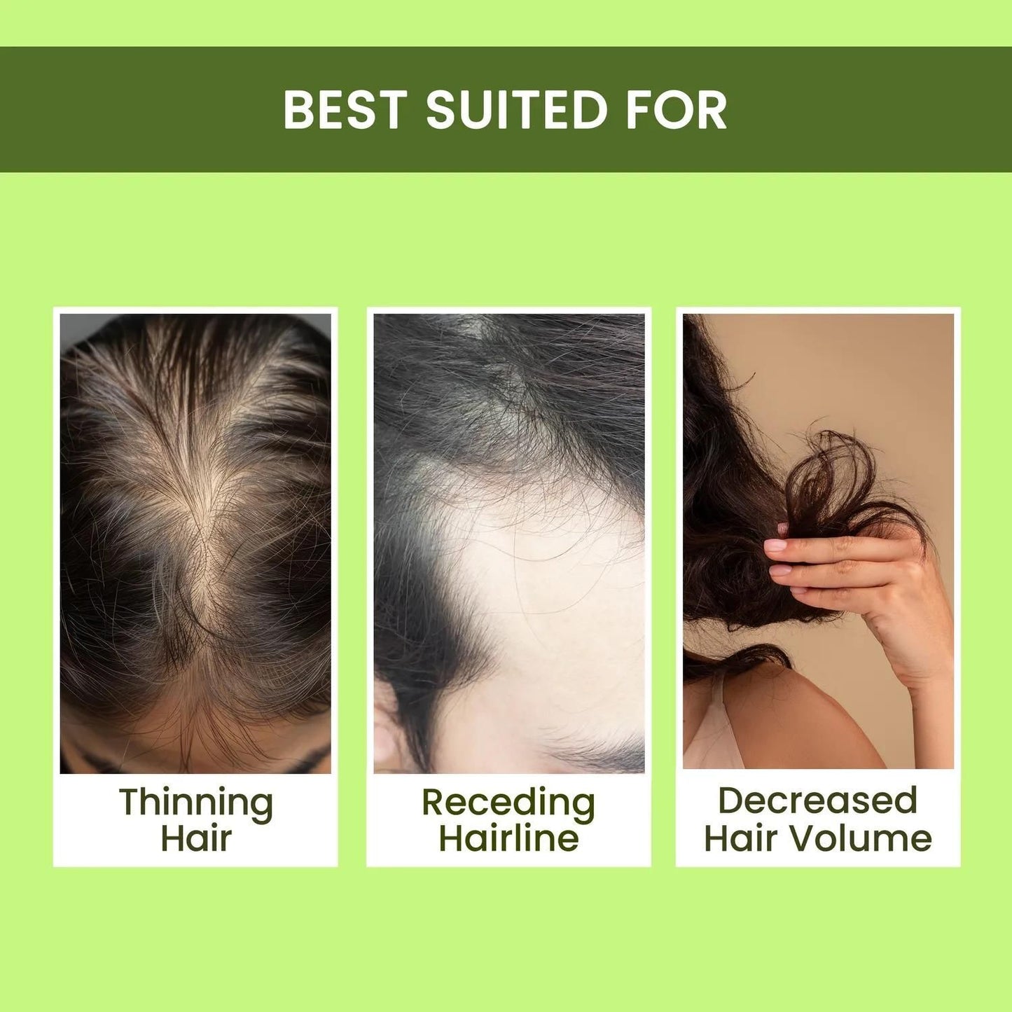 Alps Goodness Rosemary Water Spray (100 ml) | Rosemary water for hair | Hair Spray for Hair Growth | Viral Rosemary Spray | #1 Bestselling Spray Regrowth Buy 1 Get 2 Free